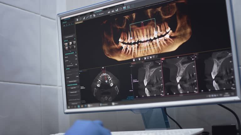 Full Mouth Reconstruction in Maple Grove, MN